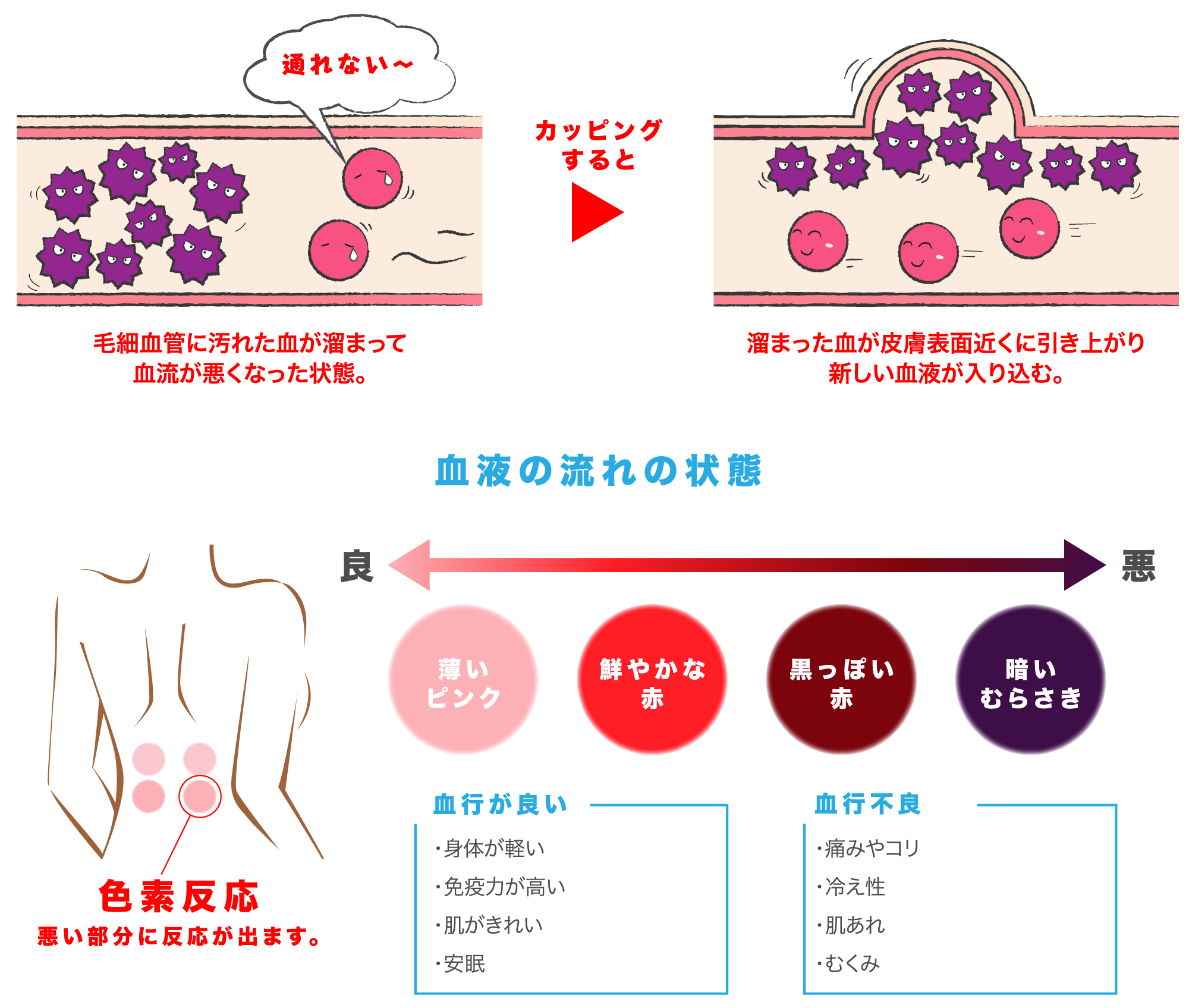 盛岡カッピング